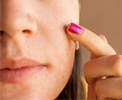 tratamiento antiacne